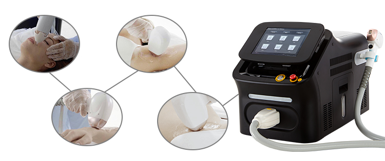 Portable Laser Hair Removal Equipment