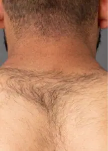 Popular Treatments Before & After